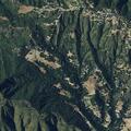 Female falls in shower after surgery at Carmel Valley
