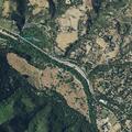 Elderly woman treated for high blood pressure in Carmel Valley