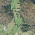 Man with gallstones reported near Family Road in Pall Mall
