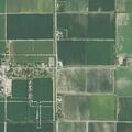 Woman with liver disease and shoulder pain treated near US Highway 62