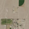 Female detainee with abdominal pain at detention center
