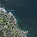 Man in severe pain after bladder surgery in Pacific Grove