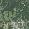 Person with breathing issues after neck surgery near Micah's Crossing