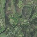 Person suffering allergic reaction to medicine at Pennington Gap