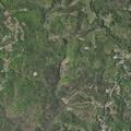 Man with neck pain and swallowing difficulty in Bassett