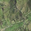 Elderly man with Parkinson's has abdominal pain and can't walk