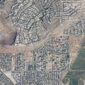 75-year-old woman sick with dizziness and vomiting in Utah