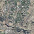 79-year-old male falls with head injury and bleeding
