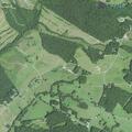 72-year-old female with leukemia treated for nosebleed and aches