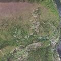 76-year-old male pulled catheter near Narrows