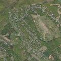 83-year-old male has severe breathing difficulties