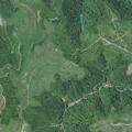 Man suffers pain from kidney stones at Miller Hill