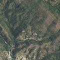 Person suffering possible anxiety attack in Mariposa
