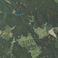 Person having a stroke near Candleberry Drive