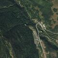 11-year-old having difficulty breathing at Cascade Village