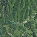 75-year-old man having chest pain near Umber Fork Road