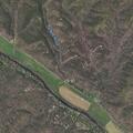 Man with chest pain and numbness near Eagle Rock