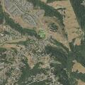 Person with severe headache near Hayward