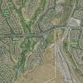 77-year-old male with possible stroke in San Ramon