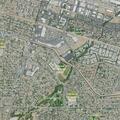 20-year-old woman with chest pain at Los Altos place