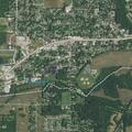 60-year-old female reported with breathing difficulty