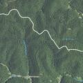 84-year-old woman with shortness of breath in WV
