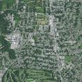 77-year-old woman with chest pain near Louisville