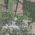 76-year-old woman fallen with possible broken rib