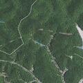 Male with throat cancer choking at home in Morehead