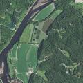 26-year-old male with possible blood clot at campground