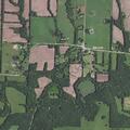 75-year-old man with chest pain in Bates County