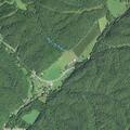 Child with low blood pressure near Shenandoah Mountain Drive