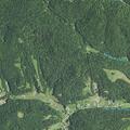 Woman experiencing rib pain near Garretts Bend