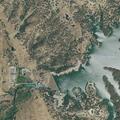 34-year-old female with abdominal pain at Lake Amador