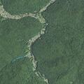 Man fatigued and unable to urinate for week in West Virginia