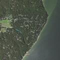 62-year-old woman with severe abdominal pain at Beach Drive