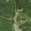 Male biker suffers sternal fracture at Snowshoe Mountain