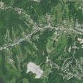 70-year-old man with rectal bleeding at Molesberger Rd
