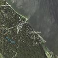 Person experiencing chest pain near Calvert Beach