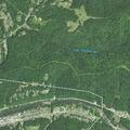 Elderly woman near Kanawha Ave E experiences arm pain after biopsy