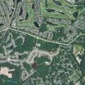 84-year-old with back pain at Mississippi Drive