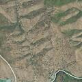 58-year-old woman with abdominal pain at Canyon Creek Resort