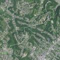 70-year-old woman with breathing difficulty at residence