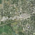 Person with recent surgery needs ambulance near West 100 South