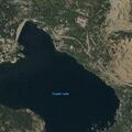 Person having a seizure at Lake Treatment Center