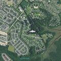 Person with diabetic complications at Simpson Dell Lane