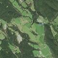 Woman with back and abdominal pain near Clem Hollow Lane