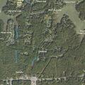 Person with abdominal pain near Cedarlea Drive