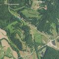 39-year-old man with migraine and blurry vision in campground