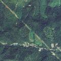 31-year-old woman reports abdominal pain at residence